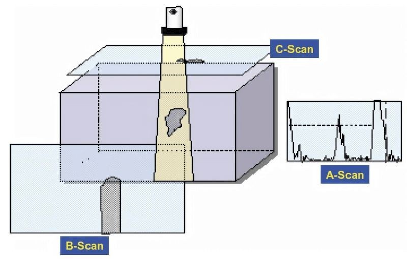 تفاوت ضخامت سنج A-scan و B-scan